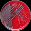 Yersinia enterocolitica + Enterococcus faecalis + Escherichia coli, Columbia agar