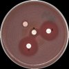 Streptococcus pyogenes, M fenotyp (eflux) rezistence