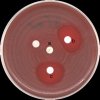 Streptococcus pyogenes, iMLS rezistence